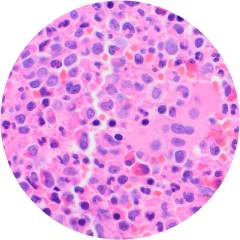 cml-trephine-60-circ16x16